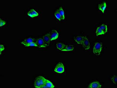 CORO1A Antibody