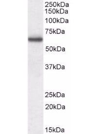 CORO1A antibody