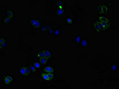 CORO1C Antibody