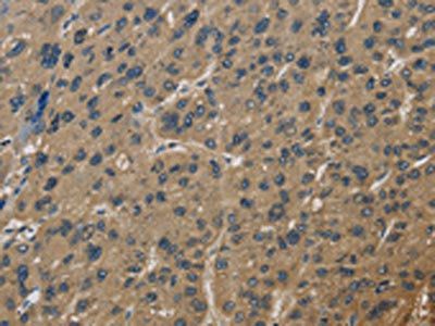 CORO1C Antibody