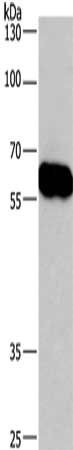 CORO1C Antibody