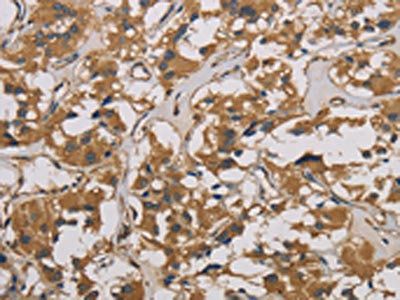 CORO1C Antibody