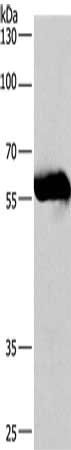 CORO1C Antibody
