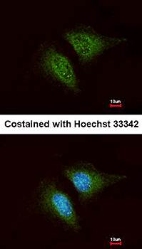 Coronin 3 Rabbit Polyclonal Antibody