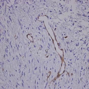 Coronin 3 Rabbit Polyclonal Antibody