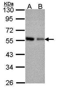 Coronin 3 Rabbit Polyclonal Antibody