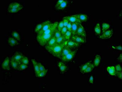 Corticosteroid-binding globulin antibody