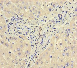 Corticosteroid-binding globulin antibody