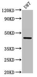 Corticosteroid-binding globulin antibody