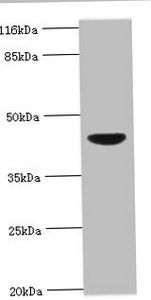 Corticosteroid-binding globulin antibody