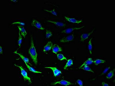 CRHR1 Antibody
