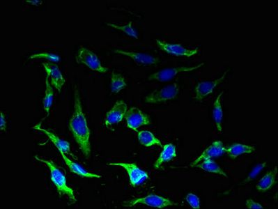 Corticotropin-releasing factor R 1 antibody