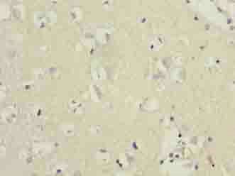 CRHR1 Antibody