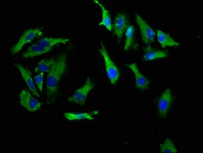 CRHR1 Antibody