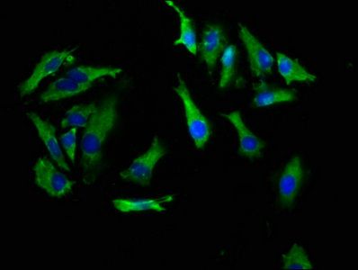 Corticotropin-releasing factor R 1 antibody