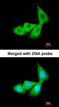 Cortisol Binding Globulin antibody