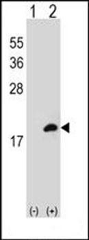 COTL1 antibody