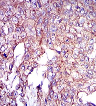 COTL1 Antibody