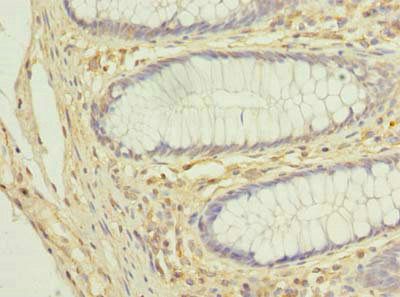 COX11 Antibody