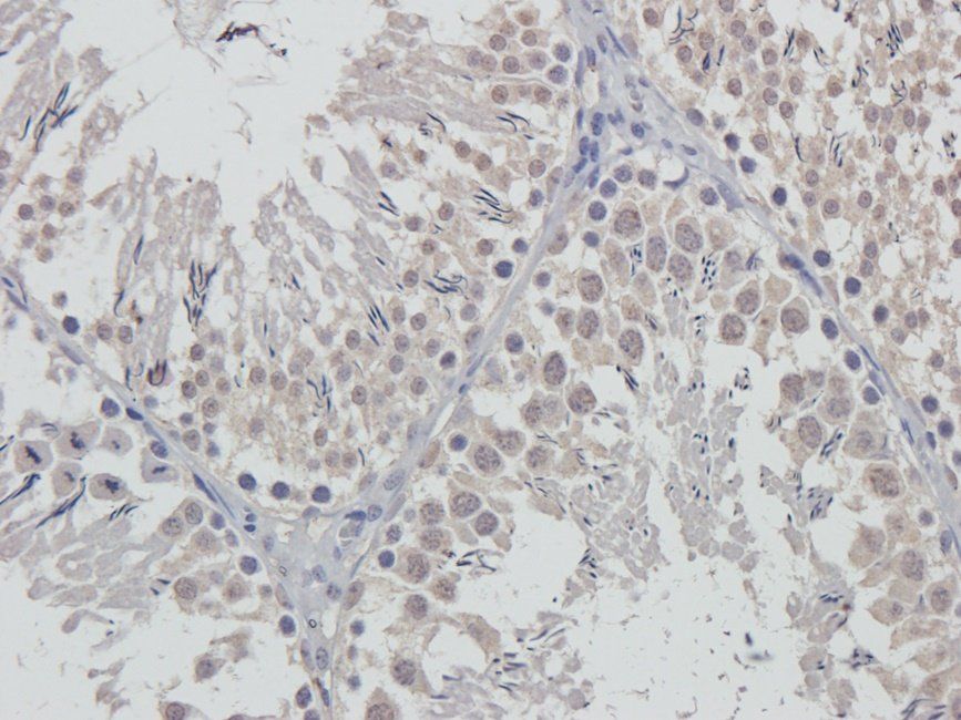 Cox2 antibody