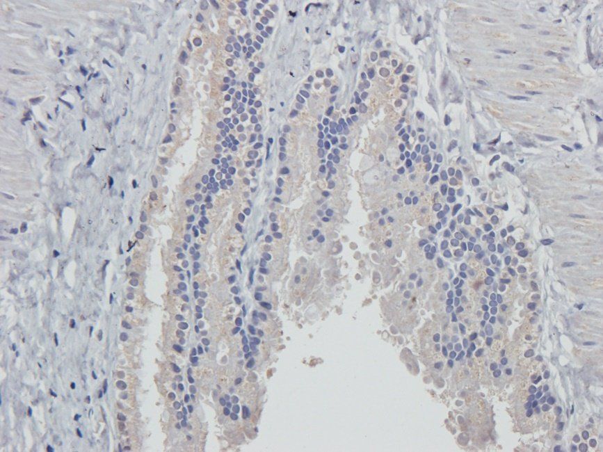 Cox2 antibody