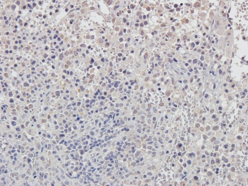 Cox2 antibody