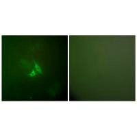 PTGS2 Antibody