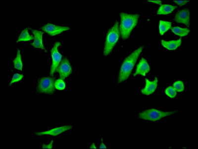 PTGS2 Recombinant Monoclonal Antibody