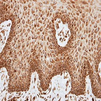 cytochrome c oxidase subunit VIa polypeptide 2 precursor antibody