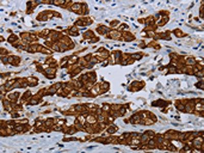 COX6B2 antibody