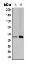 FOXC1/2 antibody