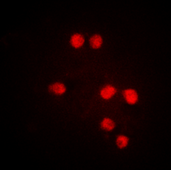 MED1 (Phospho-T1457) antibody