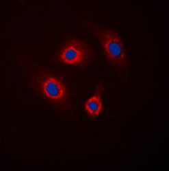 PPP1R1B (Phospho-T34) antibody