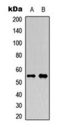 RUNX1 (Phospho-S276) antibody