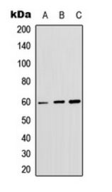 AKT1 (Phospho-S246) antibody