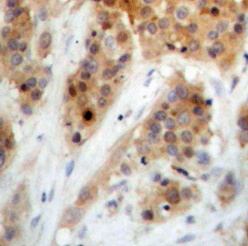 CHEK1 (Phospho-S345) antibody