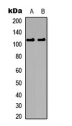 CTNND1 (Phospho-Y228) antibody