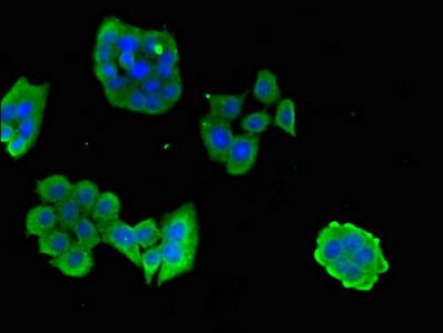 CPB2 Antibody