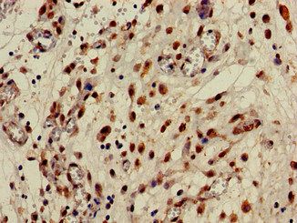 CPB2 Antibody