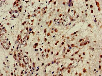 CPB2 antibody