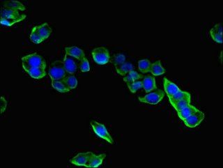 CPLX1 Antibody