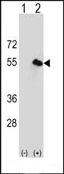 CPN1 antibody