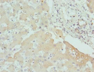 CPN1 Antibody