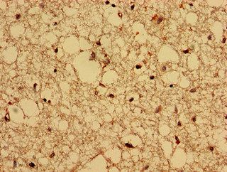 CPNE4 Antibody