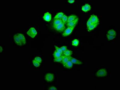 CPOX antibody