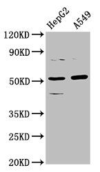 CPOX antibody