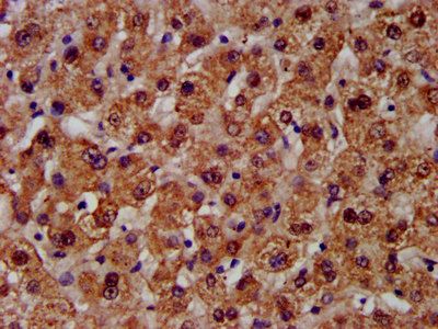 CPS1 antibody