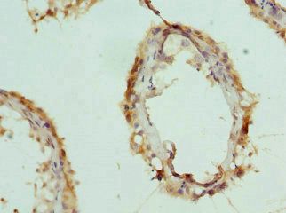 INTS11 Antibody