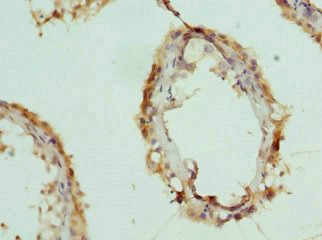 CPSF3L antibody