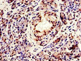 CPSF6 Antibody